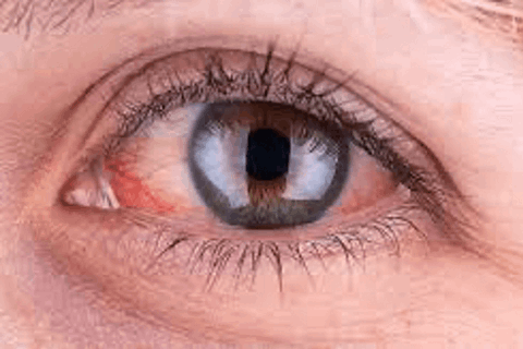 Itching Image